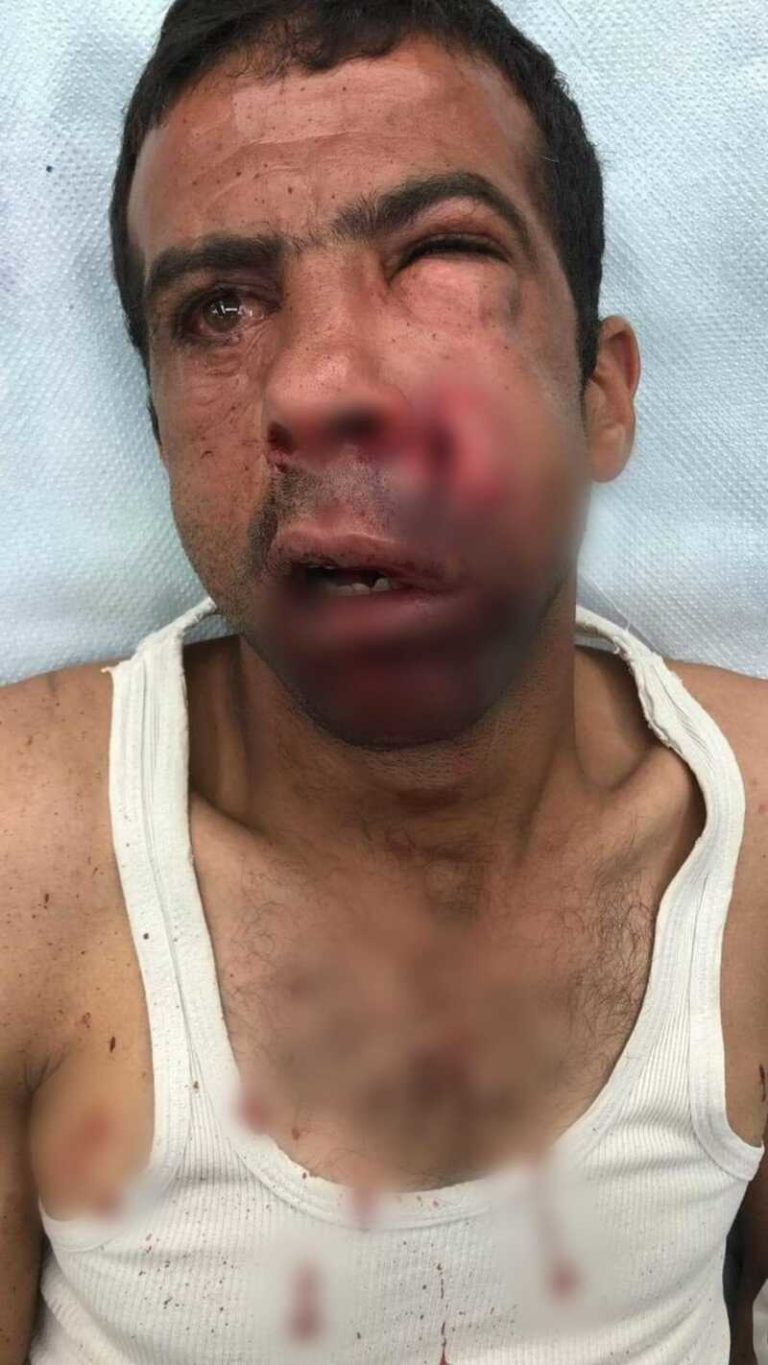 palestinian-beaten